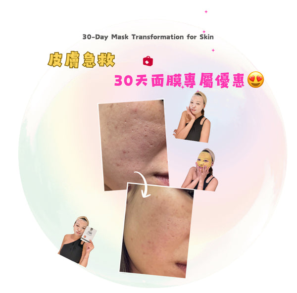 【皮膚急救⛑️✶30天面膜專屬優惠😍】
